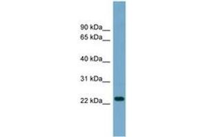Image no. 1 for anti-ADP-Ribosylation Factor-Like 8A (ARL8A) (AA 107-156) antibody (ABIN6744125) (ARL8A antibody  (AA 107-156))