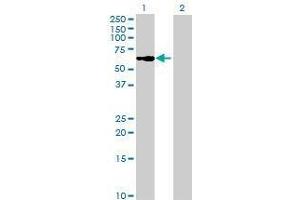 Lane 1: WFIKKN2 transfected lysate ( 63. (WFIKKN2 293T Cell Transient Overexpression Lysate(Denatured))