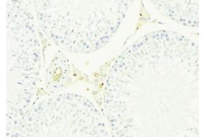 ABIN6276624 at 1/100 staining Mouse testis tissue by IHC-P.