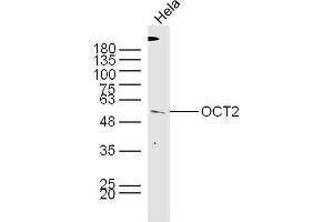 HeLa lysates probed with Rabbit Anti-OCT2 Polyclonal Antibody, Unconjugated  at 1:300 overnight at 4˚C.