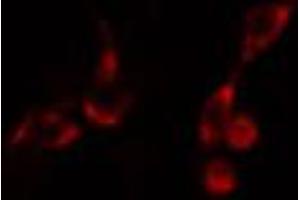 ABIN6266697 staining HeLa cells by IF/ICC.