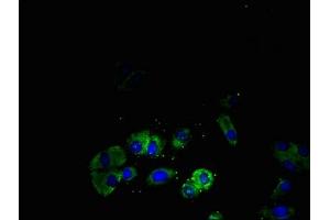 Immunofluorescent analysis of HepG2 cells using ABIN7170313 at dilution of 1:100 and Alexa Fluor 488-congugated AffiniPure Goat Anti-Rabbit IgG(H+L) (SSTR4 antibody  (AA 314-388))