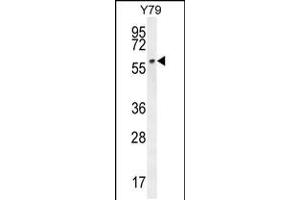 Western blot analysis in Y79 cell line lysates (35ug/lane). (LCO antibody  (C-Term))