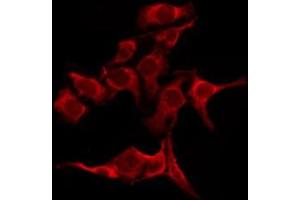 OR51B5 antibody  (Internal Region)