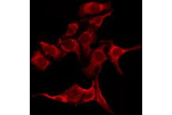 OR51B5 antibody  (Internal Region)