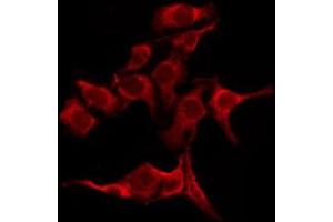 ABIN6276249 staining LOVO by IF/ICC. (OR51B5 antibody  (Internal Region))