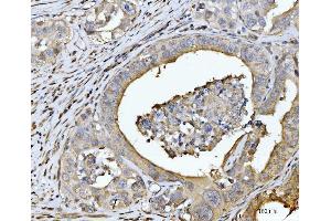 IHC analysis of EDEM3 using anti-EDEM3 antibody (ABIN7602003). (EDEM3 antibody  (AA 54-795))