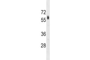 SPHK2 antibody western blot analysis in HepG2 lysate. (SPHK2 antibody  (AA 590-620))