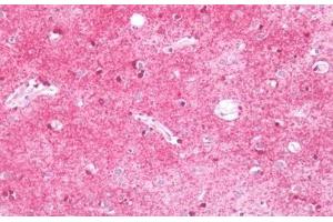 KCNMB4 antibody  (AA 86-140)