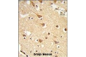 Formalin-fixed and paraffin-embedded human brain tissue reacted with ND2 Antibody (N-term), which was peroxidase-conjugated to the secondary antibody, followed by DAB staining. (MT-ND2 antibody  (N-Term))