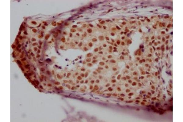 Recombinant JunB antibody