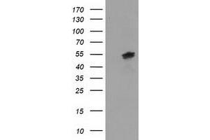 HEK293T cells were transfected with the pCMV6-ENTRY control (Left lane) or pCMV6-ENTRY LMAN1 (Right lane) cDNA for 48 hrs and lysed. (LMAN1 antibody)