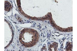 Immunohistochemical staining of paraffin-embedded Human breast tissue using anti-FDFT1 mouse monoclonal antibody. (FDFT1 antibody)