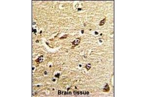 Formalin-fixed and paraffin-embedded human brain tissue reacted with ND5 Antibody (C-term), which was peroxidase-conjugated to the secondary antibody, followed by DAB staining. (MT-ND5 antibody  (C-Term))