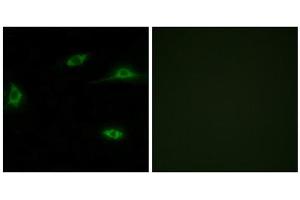 Immunofluorescence analysis of LOVO cells, using OR2T11 antibody. (OR2T11 antibody  (Internal Region))