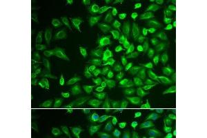 Immunofluorescence analysis of U2OS cells using LRat Polyclonal Antibody (LRAT antibody)