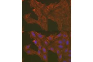 Immunofluorescence analysis of U2OS cells using [KO Validated] Caspase-3 Rabbit pAb (ABIN6131582, ABIN6137962, ABIN6137964 and ABIN6215049) at dilution of 1:100 (40x lens). (Caspase 3 antibody  (AA 55-160))