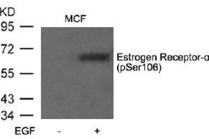 Image no. 3 for anti-Estrogen Receptor 1 (ESR1) (pSer106) antibody (ABIN196740) (Estrogen Receptor alpha antibody  (pSer106))