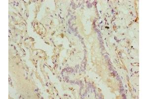 Immunohistochemistry of paraffin-embedded human lung tissue using ABIN7148645 at dilution of 1:100 (CMC1 antibody  (AA 1-106))