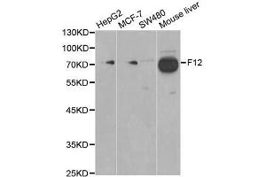 Western blot analysis of extracts of various cell lines, using F12 antibody. (F12 antibody  (AA 336-615))
