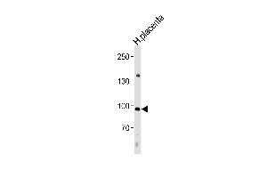 NFATC4 Antibody (C-term) (ABIN657086 and ABIN2846246) western blot analysis in human placenta tissue lysates (35 μg/lane). (NFATC4 antibody  (C-Term))