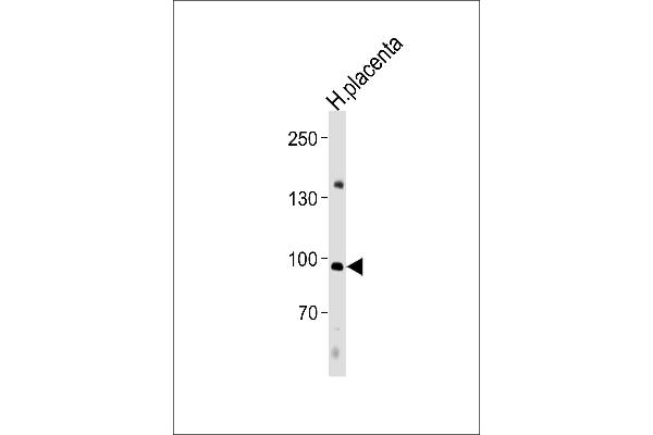 NFATC4 anticorps  (C-Term)