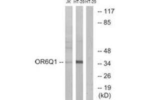 Western blot analysis of extracts from Jurkat/HT-29 cells, using OR6Q1 Antibody. (OR6Q1 antibody  (AA 23-72))