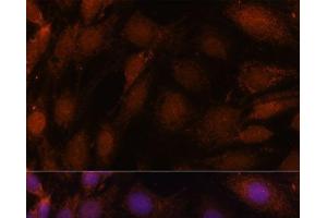 Immunofluorescence analysis of C6 cells using GCAT Polyclonal Antibody at dilution of 1:100. (GCAT antibody)