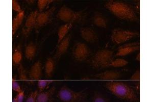 Immunofluorescence analysis of C6 cells using GCAT Polyclonal Antibody at dilution of 1:100.