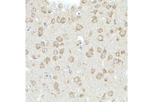 Immunohistochemistry of paraffin-embedded mouse brain using RHOT2 Rabbit pAb (ABIN3016307, ABIN3016308, ABIN1682532 and ABIN6219710) at dilution of 1:50 (40x lens). (RHOT2 antibody  (AA 280-480))