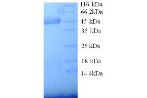 SDS-PAGE (SDS) image for Selectin E (SELE) (AA 23-429) protein (His tag) (ABIN7478982)