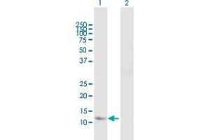 Western Blot analysis of FABP5 expression in transfected 293T cell line by FABP5 MaxPab polyclonal antibody. (FABP5 antibody  (AA 1-135))