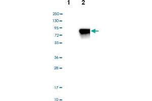 Western blot analysis of Lane 1: Negative control (vector only transfected HEK293T lysate), Lane 2: Over-expression Lysate (Co-expressed with a C-terminal myc-DDK tag (~3. (SOX9 antibody)