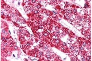 Human Adrenal (formalin-fixed, paraffin-embedded) stained with EIF4G2 antibody ABIN214749 at 5 ug/ml followed by biotinylated goat anti-rabbit IgG secondary antibody ABIN481713, alkaline phosphatase-streptavidin and chromogen. (EIF4G2 antibody  (AA 766-815))