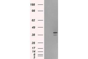 HEK293T cells were transfected with the pCMV6-ENTRY control (Left lane) or pCMV6-ENTRY ILF2 (Right lane) cDNA for 48 hrs and lysed. (ILF2 antibody)