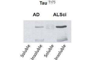Western blot detection of insoluble phospho-Tau protein using the anti-Tau (Thr-175) antibody in samples isolated from patients with a neurodegenerative disease (Amyotropic lateral sclerosis, ALS or Alzheimer’s disease, AD (tau antibody  (pThr175))