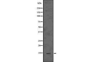 Western blot analysis of ASIP using 293 whole  lysates. (ASIP antibody  (Internal Region))