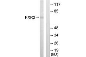 Western blot analysis of extracts from COLO205 cells, using FXR2 Antibody. (FXR2 antibody  (AA 551-600))