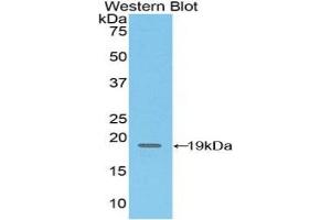 Detection of Recombinant CD97, Mouse using Polyclonal Antibody to Cluster Of Differentiation 97 (CD97) (CD97 antibody  (AA 32-173))