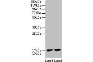 Western blot All lanes: mpt63 antibody at 2 μg/mL Lane 1: Recombinant Mycobacterium tuberculosis Immunogenic protein MPT63 protein 1 μg Lane 2: Recombinant Mycobacterium tuberculosis Immunogenic protein MPT63 protein 0. (MPT63 antibody  (AA 30-159))