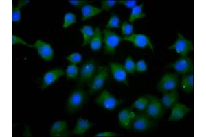 Immunofluorescence staining of A549 cells with ABIN7163100 at 1:133, counter-stained with DAPI.
