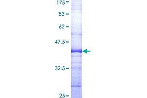 TRAF3IP2 Protein (AA 451-565) (GST tag)