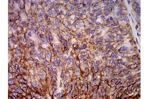 Immunohistochemistry (IHC) image for anti-Major Histocompatibility Complex, Class I, B (HLA-B) (AA 241-362) antibody (ABIN5542338)