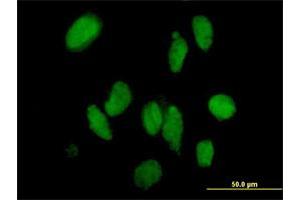 Immunofluorescence of purified MaxPab antibody to DMAP1 on HeLa cell.