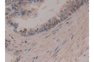 Immunohistochemistry (IHC) image for anti-Cytochrome C, Somatic (CYCS) (AA 5-100) antibody (ABIN7442270)
