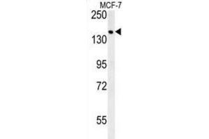 Western Blotting (WB) image for anti-Sterile alpha Motif Domain Containing 9 (SAMD9) antibody (ABIN3002418)