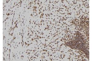 ABIN6273826 at 1/100 staining Human gastric tissue by IHC-P. (Becn2 (N-Term) antibody)