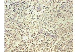 Immunohistochemical of paraffin-embedded human spleen organization using ABIN7161512 at dilution of 1:200 (Lipocalin 2 antibody)