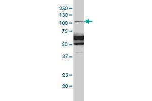 RASA1 monoclonal antibody (M01A), clone 2C12 Western Blot analysis of RASA1 expression in IMR-32 . (RASA1 antibody  (AA 948-1047))