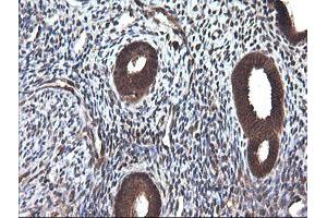 Image no. 1 for anti-Cancer/testis Antigen 1B (CTAG1B) antibody (ABIN1499906) (CTAG1B antibody)